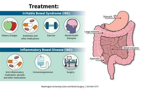 Management Options for Irritable Bowel Syndrome